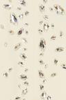 crystal speckled mini dress