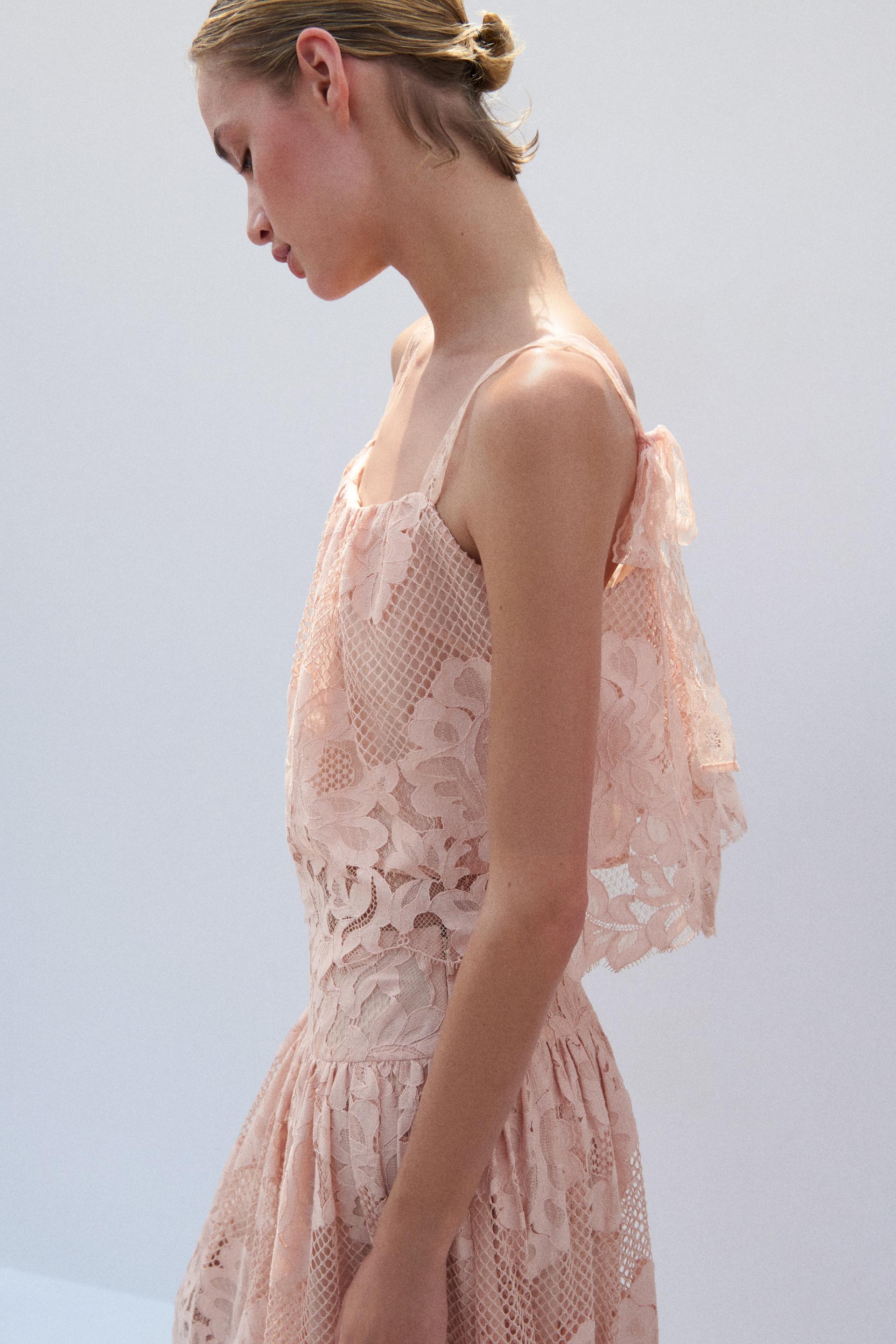 scalloped lace top